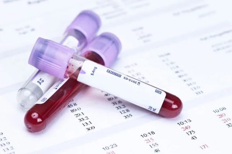 Xét nghiệm chỉ số hemoglobin để phát hiện thiếu máu khi mang thai